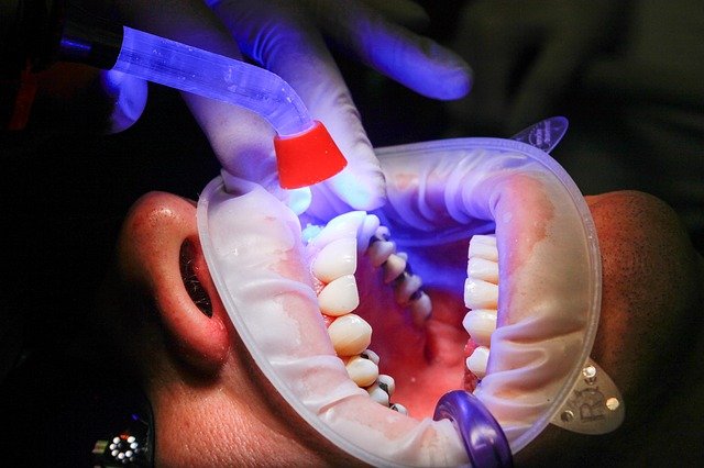 cirugía e implantes dentales vigo